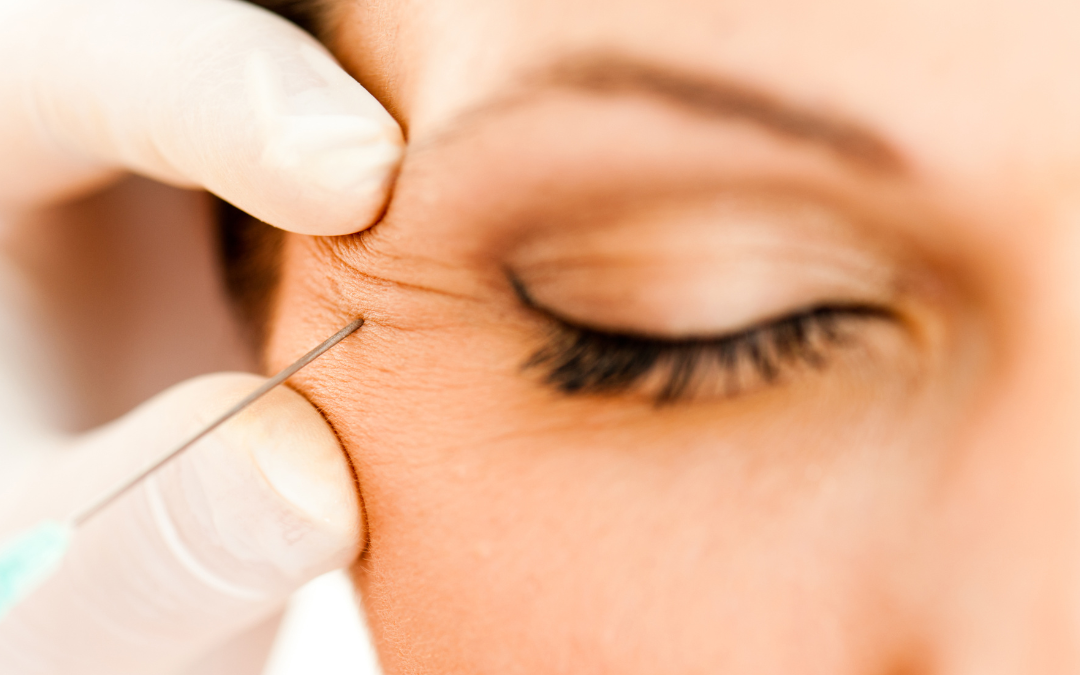 botox needle near eye