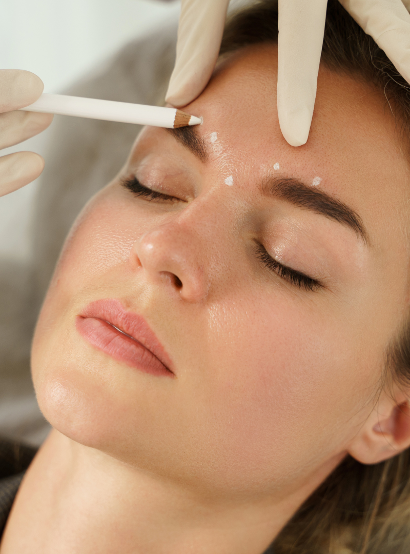 female legs showing spider veins