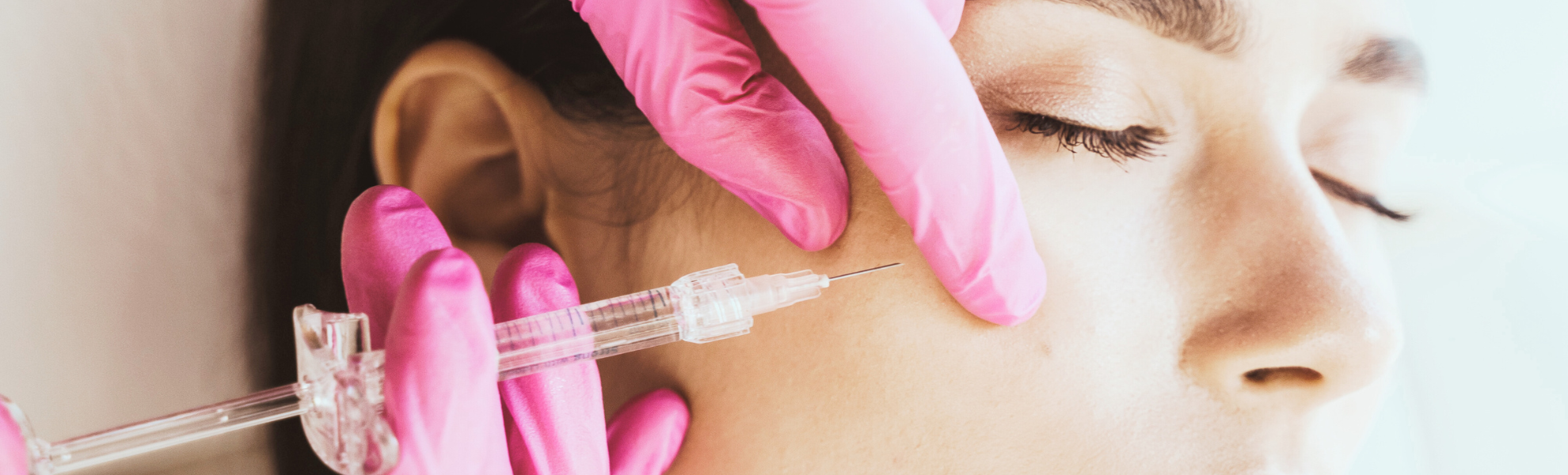 female legs showing spider veins