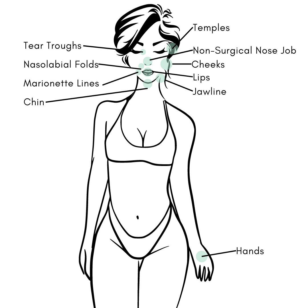 female legs showing spider veins